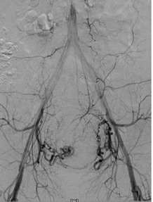 Endocav-Fig-2-1 Endocav-Fig-2-1