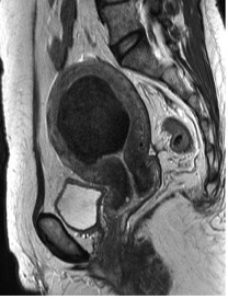 Endocav-Fig-3-2 Endocav-Fig-3-2