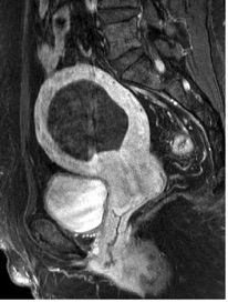 Endocav-Fig-3-3 Endocav-Fig-3-3