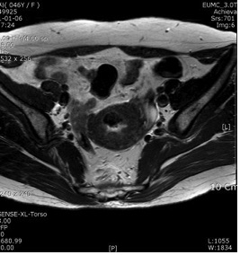 Endocav-Fig-4-1 Endocav-Fig-4-1