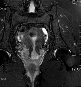 Endocav-Fig-4-2-2 Endocav-Fig-4-2-2