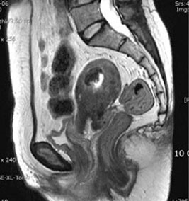 Endocav-Fig-4-3-3 Endocav-Fig-4-3-3