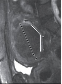 Endocav-Fig-5-1 Endocav-Fig-5-1